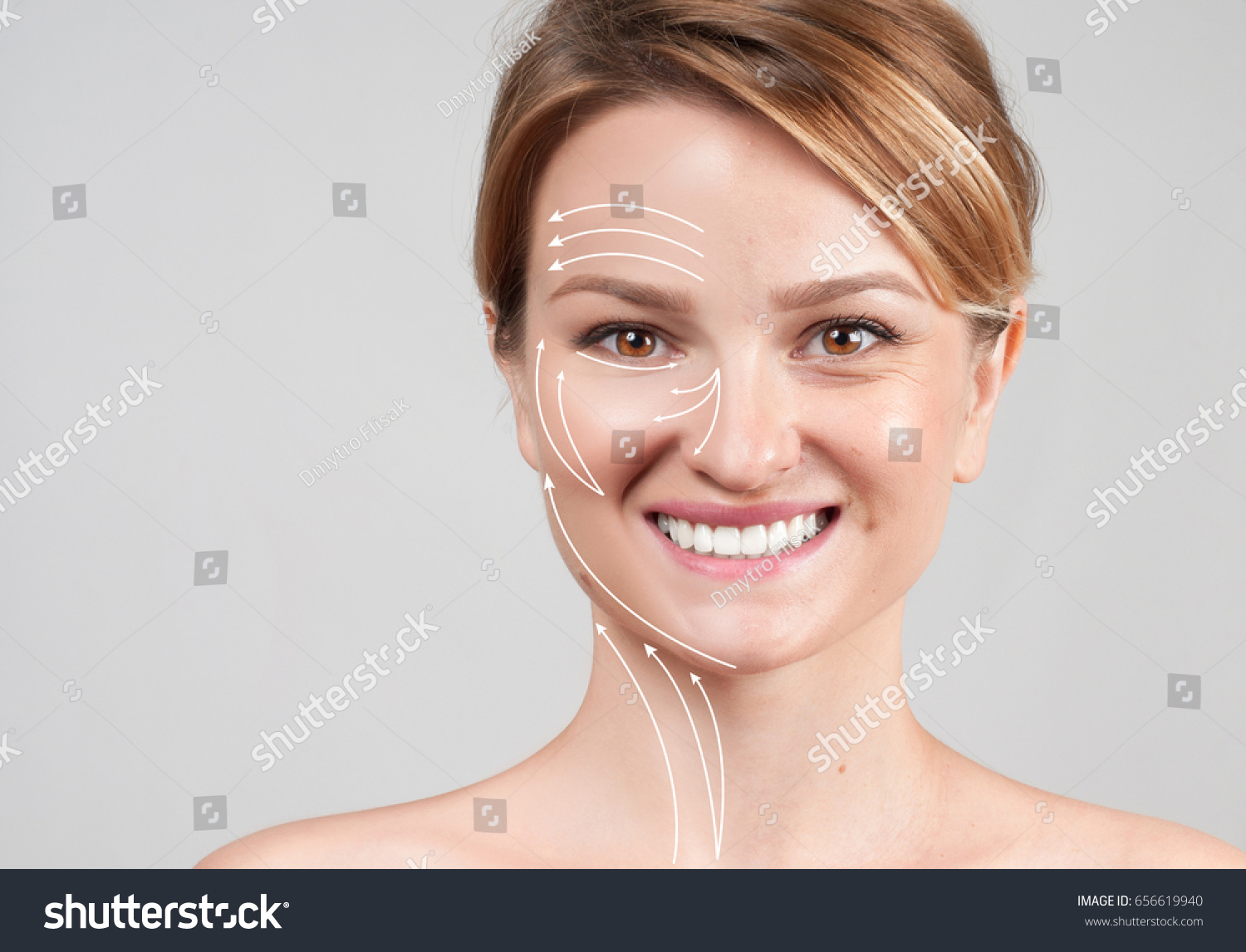 RINOPLASTIA