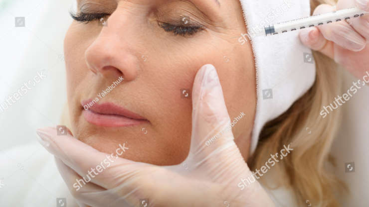 Botox en el tratamiento de las arrugas