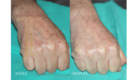 Medicina y Cirugía Estética Facial y Corporal en Valencia Dr. Jorge Torres