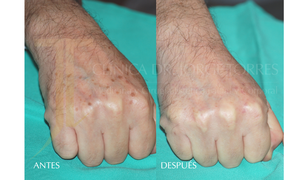 Medicina y Cirugía Estética Facial y Corporal en Valencia Dr. Jorge Torres