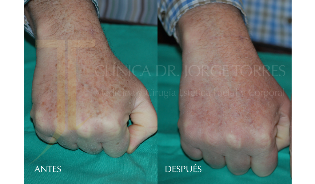 Medicina y Cirugía Estética Facial y Corporal en Valencia Dr. Jorge Torres