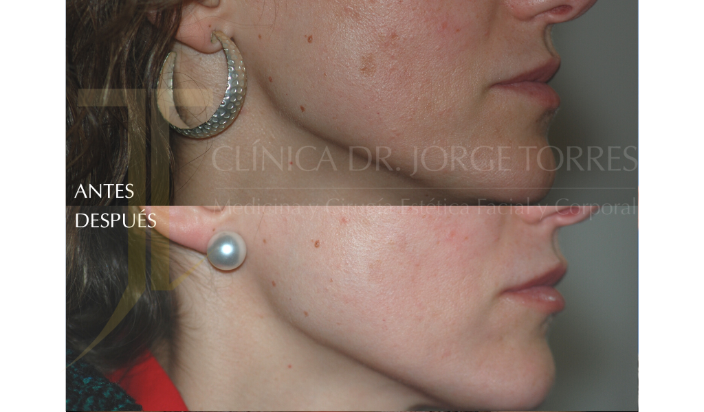 Medicina y Cirugía Estética Facial y Corporal en Valencia Dr. Jorge Torres