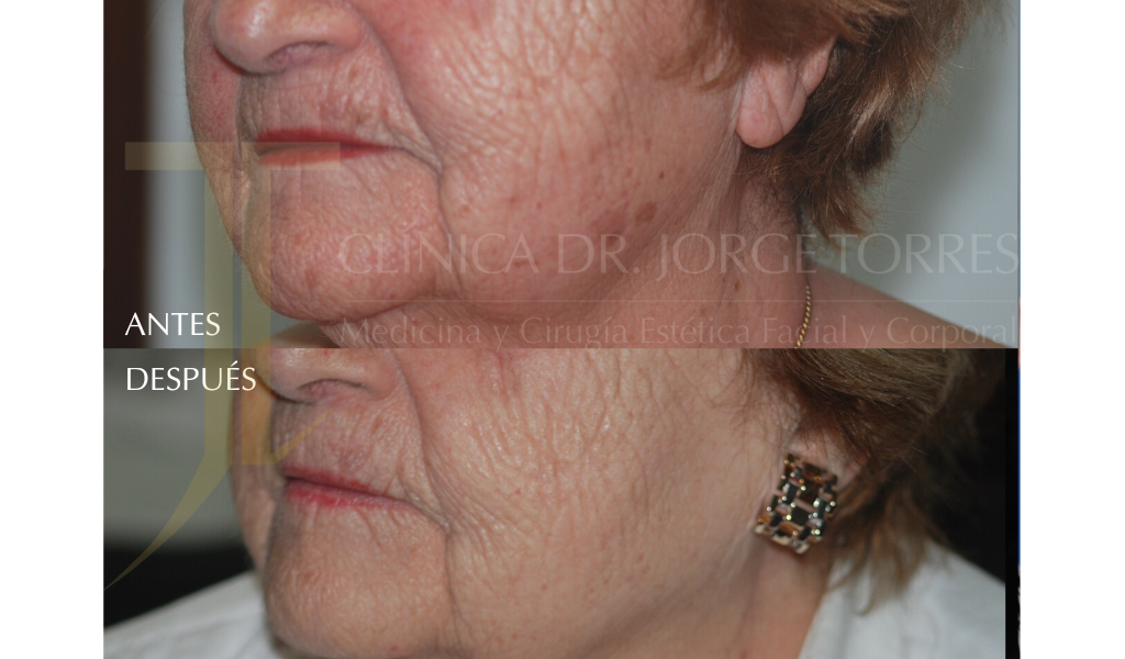 Medicina y Cirugía Estética Facial y Corporal en Valencia Dr. Jorge Torres