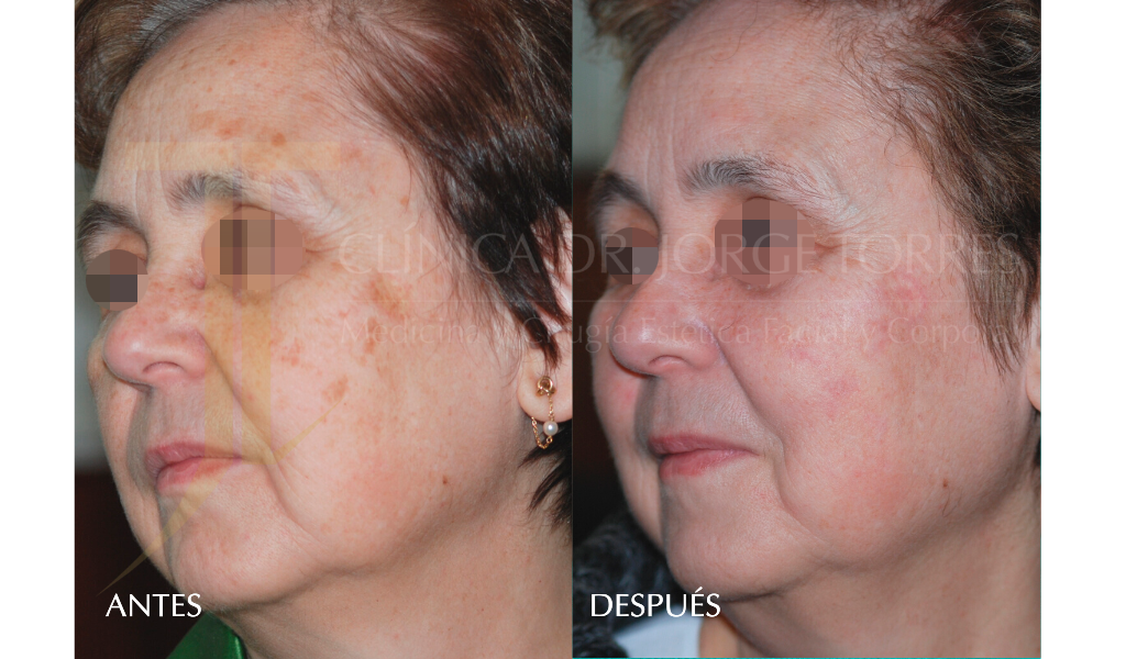 Medicina y Cirugía Estética Facial y Corporal en Valencia Dr. Jorge Torres