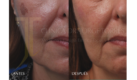Medicina y Cirugía Estética Facial y Corporal en Valencia Dr. Jorge Torres