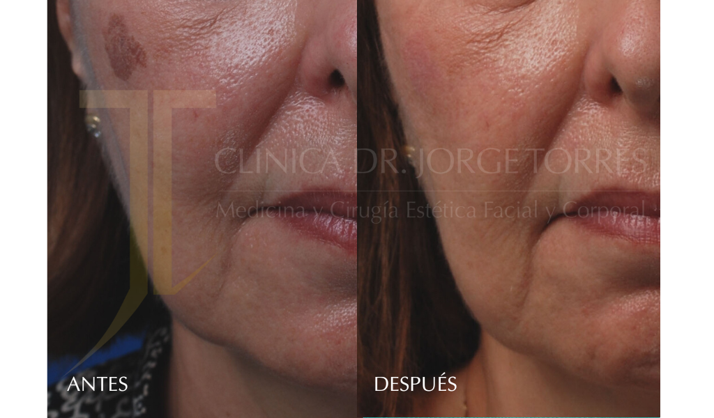 Medicina y Cirugía Estética Facial y Corporal en Valencia Dr. Jorge Torres