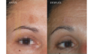 Medicina y Cirugía Estética Facial y Corporal en Valencia Dr. Jorge Torres