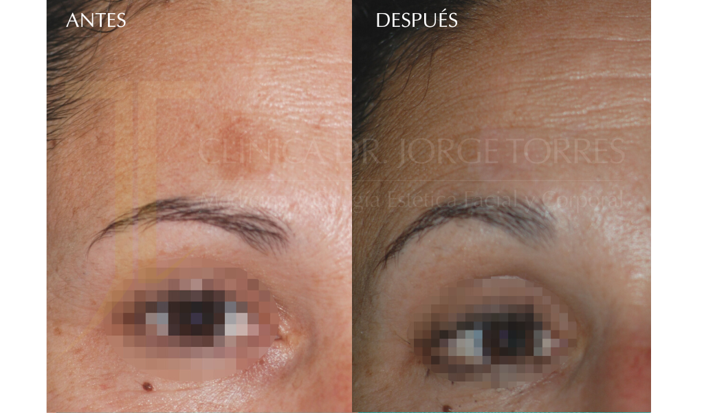 Medicina y Cirugía Estética Facial y Corporal en Valencia Dr. Jorge Torres