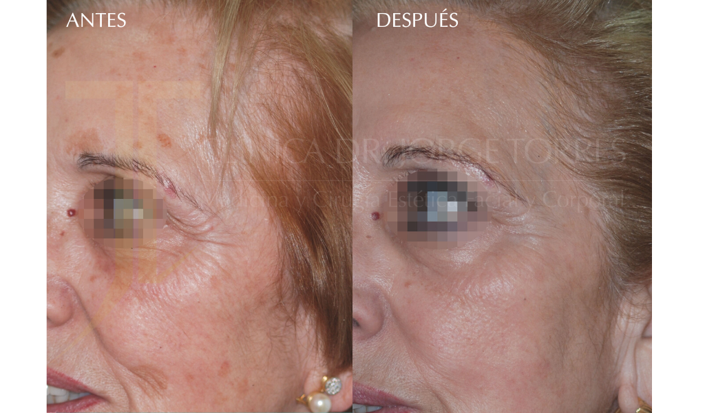 Medicina y Cirugía Estética Facial y Corporal en Valencia Dr. Jorge Torres