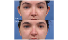 Medicina y Cirugía Estética Facial y Corporal en Valencia Dr. Jorge Torres