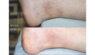 Medicina y Cirugía Estética Facial y Corporal en Valencia Dr. Jorge Torres