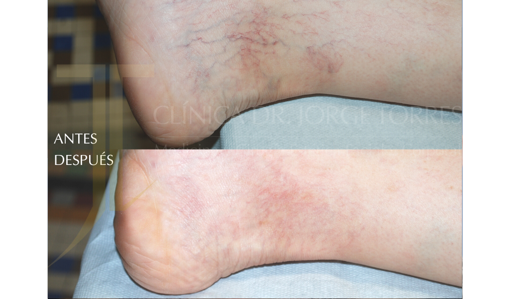 Medicina y Cirugía Estética Facial y Corporal en Valencia Dr. Jorge Torres