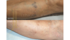 Medicina y Cirugía Estética Facial y Corporal en Valencia Dr. Jorge Torres