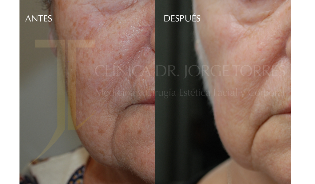 Medicina y Cirugía Estética Facial y Corporal en Valencia Dr. Jorge Torres