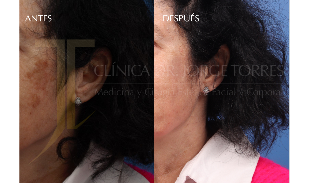 Medicina y Cirugía Estética Facial y Corporal en Valencia Dr. Jorge Torres