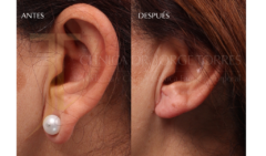 Medicina y Cirugía Estética Facial y Corporal en Valencia Dr. Jorge Torres