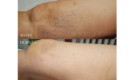 Medicina y Cirugía Estética Facial y Corporal en Valencia Dr. Jorge Torres