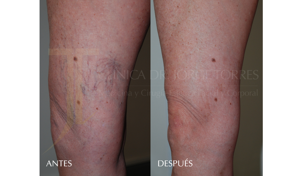 Medicina y Cirugía Estética Facial y Corporal en Valencia Dr. Jorge Torres