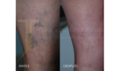 Medicina y Cirugía Estética Facial y Corporal en Valencia Dr. Jorge Torres