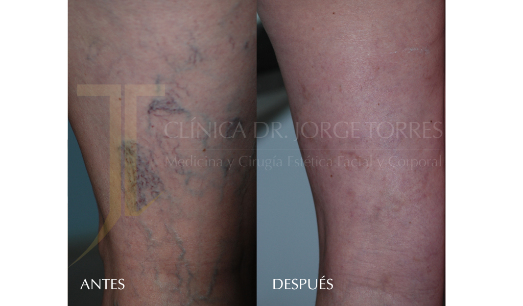 Medicina y Cirugía Estética Facial y Corporal en Valencia Dr. Jorge Torres